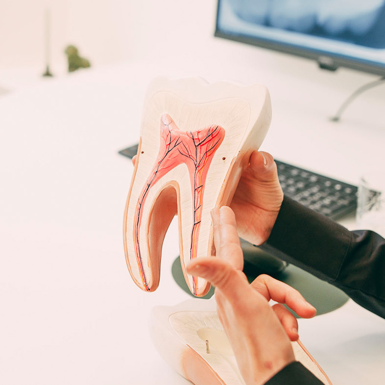 Deitailaufnahme eines Zahn-Querschnitts im Zentrum für Zahnmedizin Dr. Sorg & Kollegen damit erklären wir eine Wurzelbehandlung