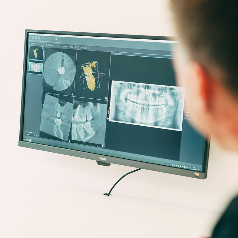 Detailaufnahme eines Röntgenbildes aus dem DVT im Zentrum für Zahnmedizin Dr. Sorg & Kollegen